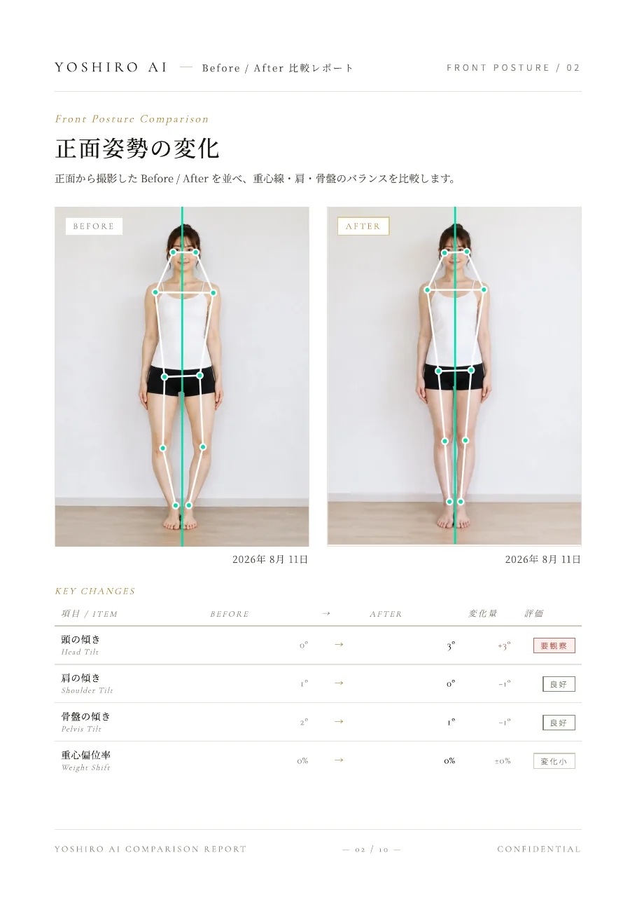 正面姿勢のBefore After比較レポート