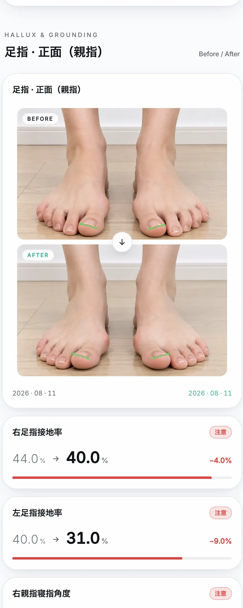 足指のBefore After比較結果画面