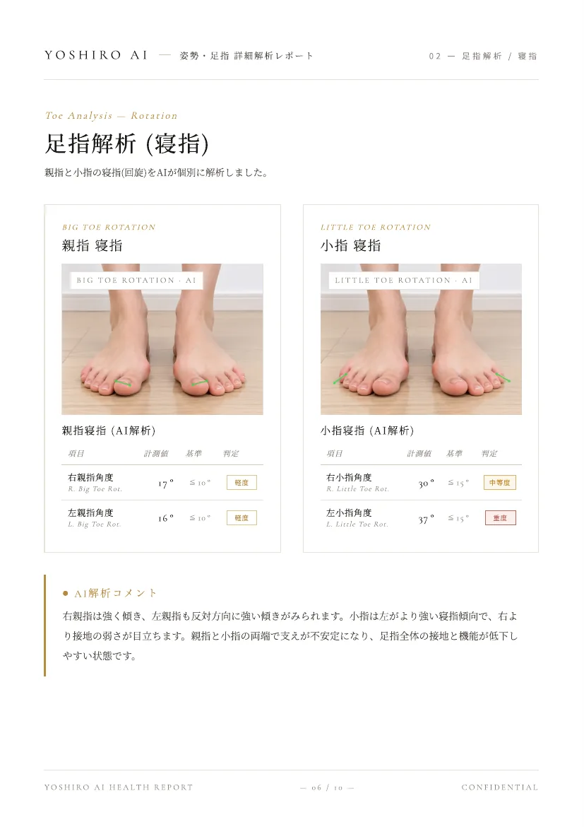 YOSHIRO AI 詳細分析レポート 足指分析（寝指）のページ