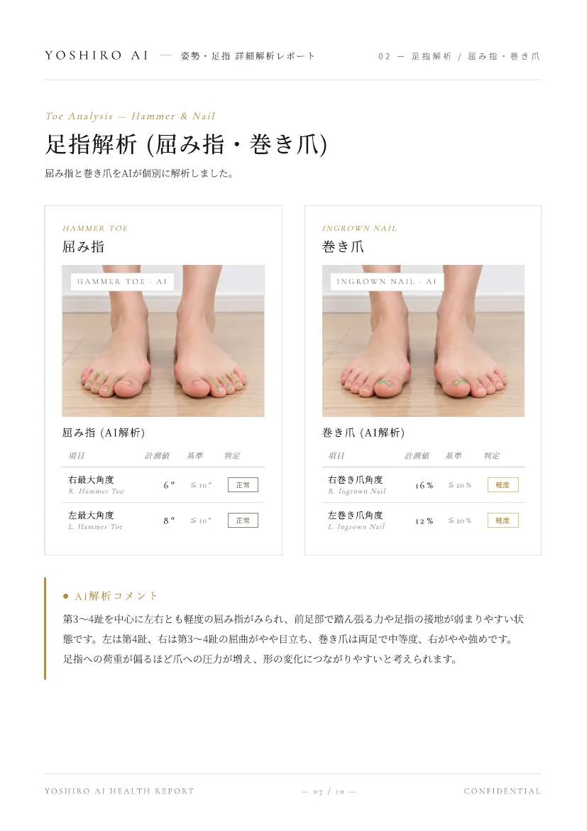 YOSHIRO AI 詳細分析レポート 屈み指・巻き爪分析のページ