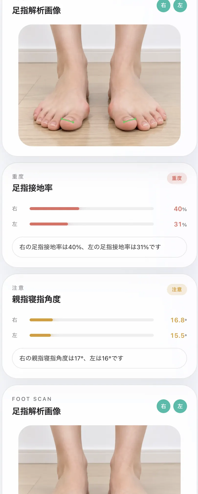 足指のAI解析結果画面